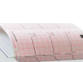 EKG-Papier für AT-1 G2 1x25 Stück 