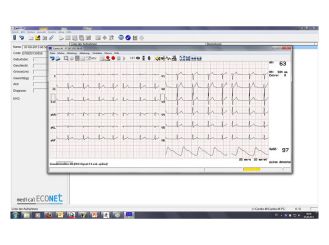Cardio M PC evaluation software 1x1 items 
